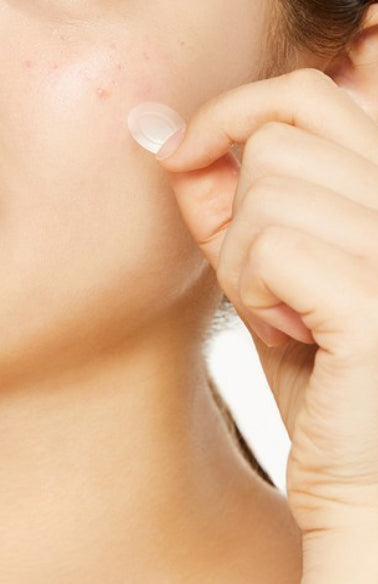 3 x COSRX AC Collection Acne Patch (26patches) from Korea by COSRX