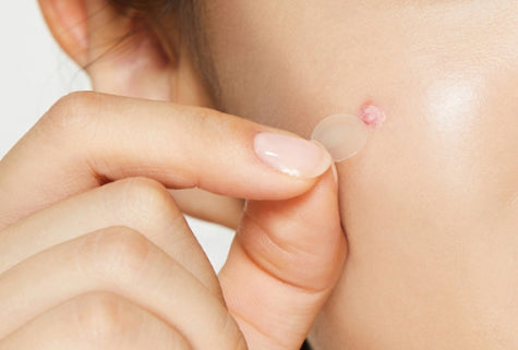 3 x COSRX Clear Fit Master Patch (18 patches) from Korea by COSRX