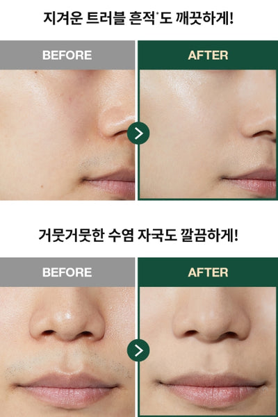 [MEN] Dr.G R.E.D Blemish For Men All In One Tone Lotion 50ml from Korea by Dr.G