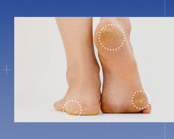 MEDI-PEEL EGF Scaling Moisture Foot Cream 130g from Korea by MEDI-PEEL