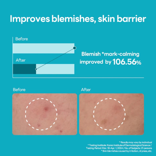 2 x MEDIHEAL Madecassoside Blemish Repair Serum 40ml from Korea