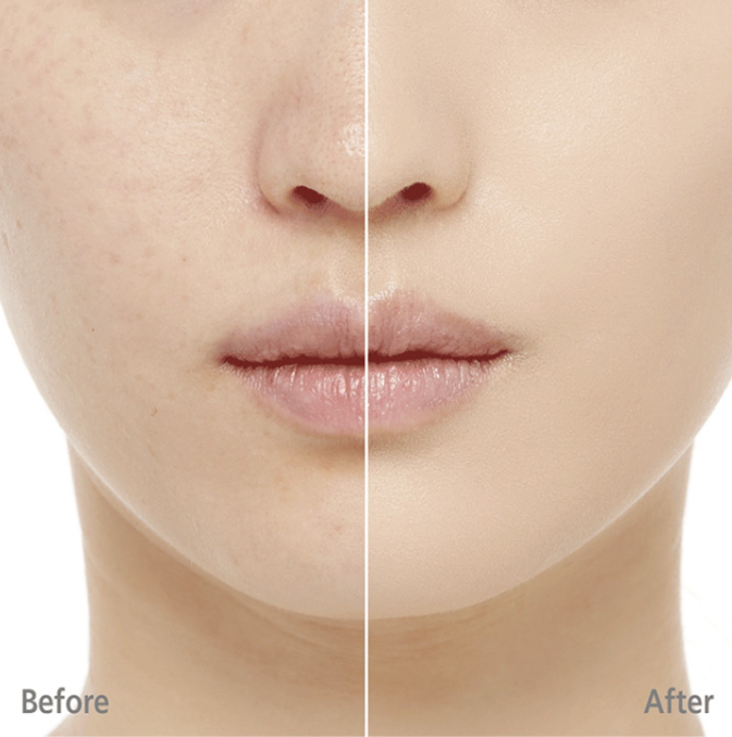 Sulwhasoo Perfecting Powder 20g from Korea by Sulwhasoo